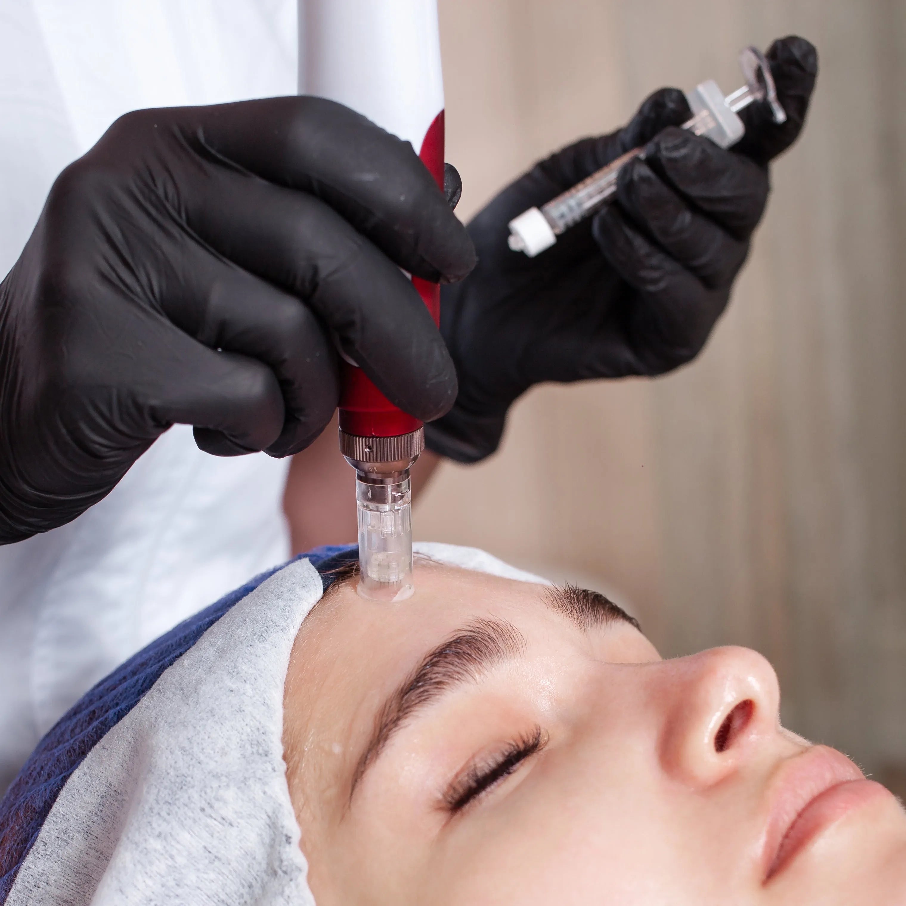 Mikronakłuwanie twarzy, szyi i dekoltu + Pink Glow/Meso BTX/Dives Acneout/Dermaheal