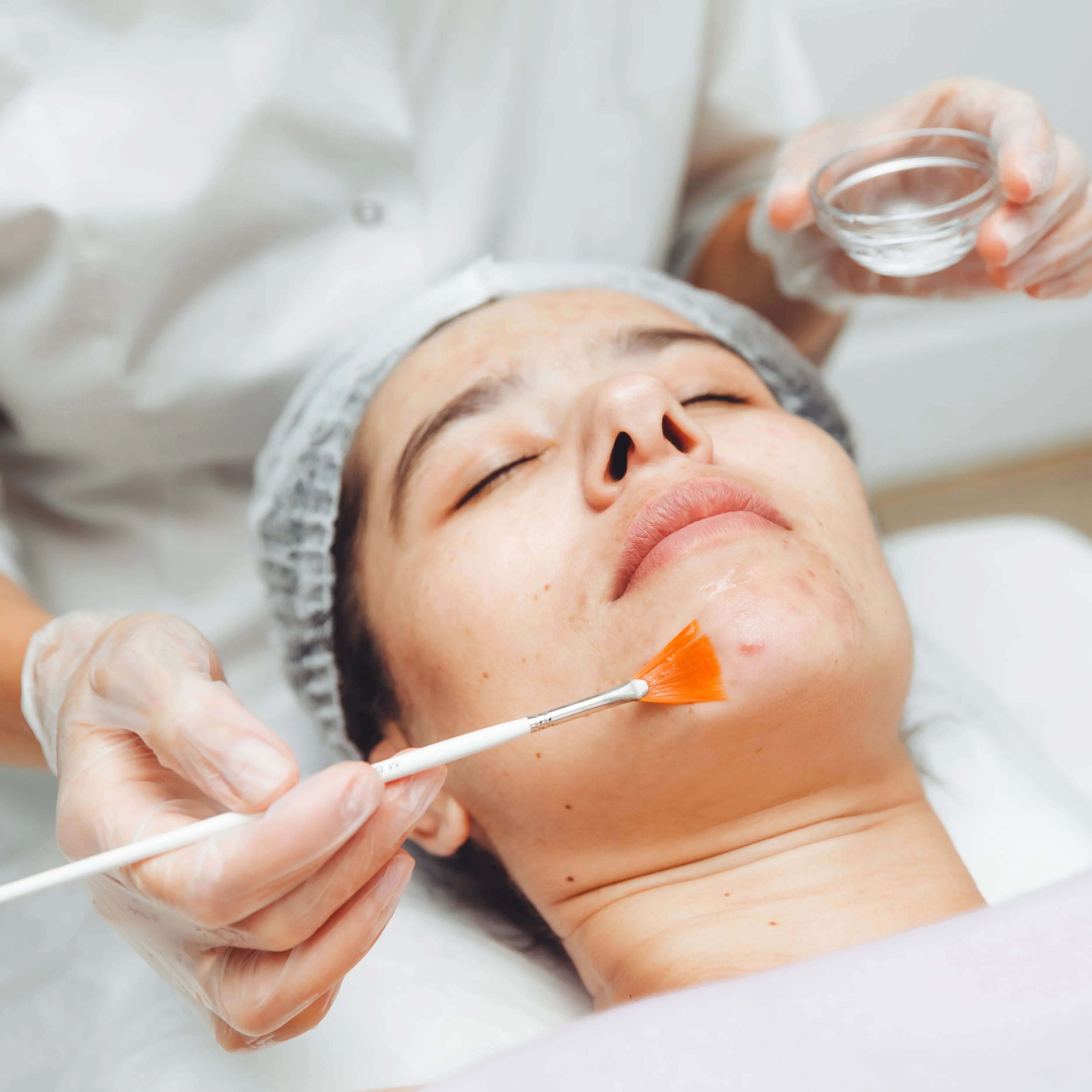 Delikatny peeling kwasowy twarzy